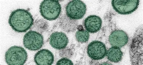 Hantavirus cruise ship MV Hondius outbreak in 2026